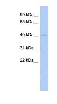 Western Blot: IFLTD1 Antibody [NBP1-56726] - Human Intestine, concentration 0.2-1 ug/ml.