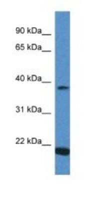 Western Blot: IFN-alpha 13 Antibody [NBP1-74124] - Titration: 1.0 ug/ml Positive Control: Placenta.