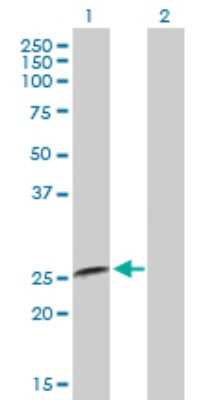 Western Blot: IFN-alpha B2/IFN-alpha 8 Antibody [H00003445-B01P] - Analysis of IFNA8 expression in transfected 293T cell line by IFNA8 polyclonal antibody.  Lane1:IFNA8 transfected lysate(20.79 KDa). Lane2:Non-transfected lysate.