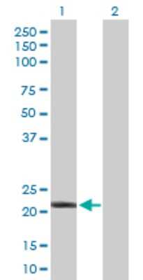 Western Blot: IFN-alpha C/IFN-alpha 10 Antibody [H00003446-D01P] - Analysis of IFNA10 expression in transfected 293T cell line by IFNA10 polyclonal antibody.Lane 1: IFNA10 transfected lysate(21.80 KDa).Lane 2: Non-transfected lysate.