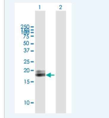 Western Blot: IFN-alpha D Antibody [H00003439-B01P-50ug] - Analysis of IFNA1 expression in transfected 293T cell line (H00003439-T02) by IFNA1 MaxPab polyclonal antibody.  Lane 1: IFNA1 transfected lysate(21.70 KDa). Lane 2: Non-transfected lysate