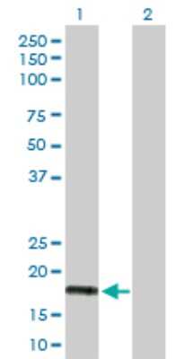 Western Blot: IFN-alpha G/IFNA5 Antibody [H00003442-D01P] - Analysis of IFNA5 expression in transfected 293T cell line by IFNA5 polyclonal antibody.Lane 1: IFNA5 transfected lysate(21.90 KDa).Lane 2: Non-transfected lysate.