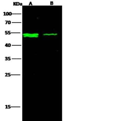 Western Blot: IFN-alpha/beta R2 Antibody (123) [NBP2-89448] - Lane A: HepG2 Whole Cell Lysate Lane B: Jurkat Whole Cell LysateLysates/proteins at 30 ug per lane. Secondary Goat Anti-Rabbit IgG H&L (Dylight800) at 1/10000 dilution. Developed using the Odyssey technique. Performed under reducing conditions. Predicted band size:57 kDa Observed band size:57 kDa