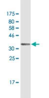 Western Blot: IFN-epsilon Antibody (2F8) [H00338376-M02] - detection against Immunogen (36.74 KDa) .