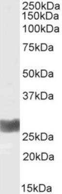 Western Blot: IFN-gamma Antibody (D9D10) [NBP2-81044] - Western Blot using anti-IFN gamma antibody (D9D10) [NBP2-81044]. Human thymus lysate (35ug protein in RIPA buffer) was resolved on a 15% SDS PAGE gel and blots probed with the rabbit IgG-chimeric version of D9D10 [NBP2-81044] at 0.1 ug/ml before detection using an anti-rabbit secondary antibody. Protein was detected by chemiluminescence. The expected unmodified running size for IFN gamma is 19.3kDa, though the form shown here is likely glycosylated. NBP2-81044 successfully detected IFN gamma in human thymus samples.