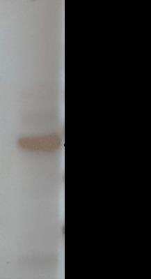 Western Blot: IFN-gamma Antibody (V2P3C12*G9) [NBP2-50436] - Analysis of IFN- gamma1 using Anti-IFN-gamma1 [V2P3C12*G9]. Dimeric IFN-gamma1 was detected in kidney leukocytes stimulated with PHA.