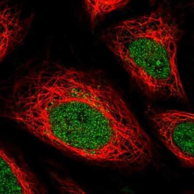 <b>Orthogonal Strategies Validation. </b>Immunocytochemistry/Immunofluorescence: IFN-gamma R2 Antibody [NBP1-90223] - Staining of human cell line SiHa shows localization to nucleoplasm & the Golgi apparatus. Antibody staining is shown in green.