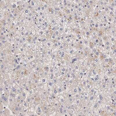 Immunohistochemistry-Paraffin: IFN-gamma R2 Antibody [NBP1-90223] - Staining of human liver shows low expression as expected.