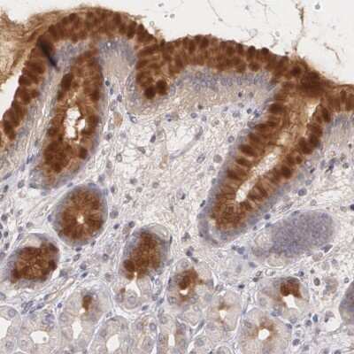 Immunohistochemistry-Paraffin: IFN-gamma R2 Antibody [NBP1-90223] - Staining of human stomach shows high expression.