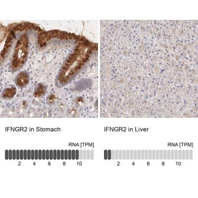 Immunohistochemistry-Paraffin: IFN-gamma R2 Antibody [NBP1-90223] - Staining in human stomach and liver tissues using anti-IFNGR2 antibody. Corresponding IFNGR2 RNA-seq data are presented for the same tissues.