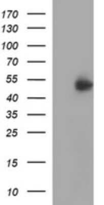 Western Blot: IFN-gamma R2 Antibody (OTI1C2) - Azide and BSA Free [NBP2-71008] - Analysis of HEK293T cells were transfected with the pCMV6-ENTRY control (Left lane) or pCMV6-ENTRY IFN gamma R2.