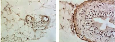 Immunohistochemistry-Paraffin: IFN-gamma R2 Antibody (RM0252-7A25) [NBP2-12430] - The Kidney tissue samples from the Folic Acid induced kidney injury model were fixed using 4% PFA at 4C for overnight and embeded in paraffin. 4um section was sublected to IHC with NBP2-12430