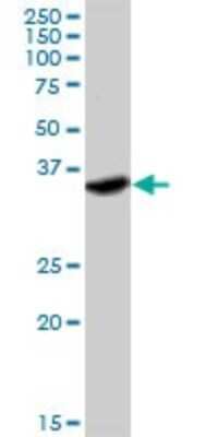 Western Blot: IFN-gamma R2 Antibody [H00003460-D01P] - Analysis of IFNGR2 expression in HeLa.