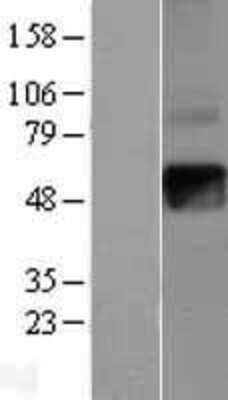 Western Blot: IFN gamma Receptor beta Overexpression Lysate (Adult Normal) [NBL1-11853] Left-Empty vector transfected control cell lysate (HEK293 cell lysate); Right -Over-expression Lysate for IFN gamma Receptor beta.