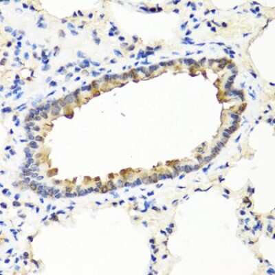 Immunohistochemistry-Paraffin: IFN-omega/IFNW1 Antibody [NBP3-03585] - Paraffin-embedded rat lung using IFN-omega/IFNW1 antibody at dilution of 1:100 (40x lens).