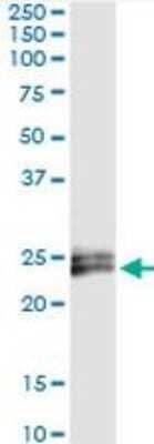 Immunoprecipitation IFN-epsilon Antibody (3B8)