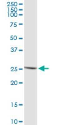 Western Blot IFN-epsilon Antibody (3B8)