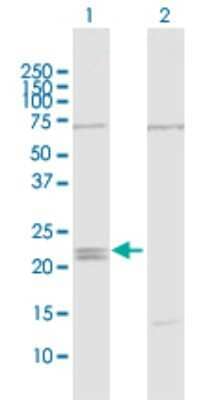 Western Blot: IFNE1 Antibody [H00338376-D01P] - Analysis of IFNE1 expression in transfected 293T cell line by IFNE1 polyclonal antibody.Lane 1: IFNE1 transfected lysate(24.40 KDa).Lane 2: Non-transfected lysate.