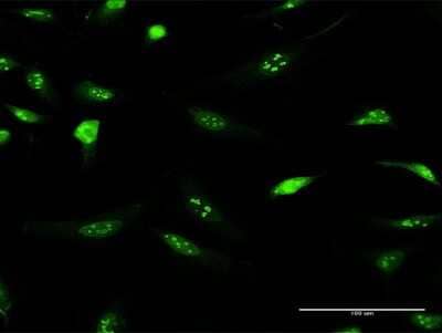 Immunocytochemistry/Immunofluorescence: IFRD2 Antibody [H00007866-D01P] - Analysis of antibody to IFRD2 on HeLa cell. Antibody concentration 10 ug/ml.