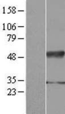 Western Blot: IFRD2 Overexpression Lysate (Adult Normal) [NBP2-07584] Left-Empty vector transfected control cell lysate (HEK293 cell lysate); Right -Over-expression Lysate for IFRD2.