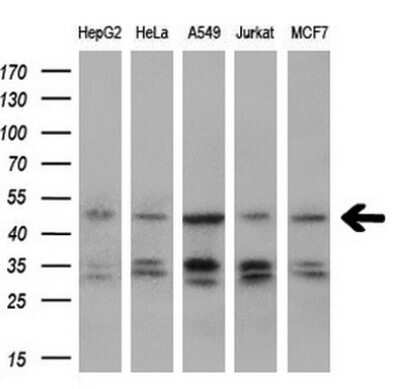 Western Blot: IGBP1 Antibody (OTI4F6) - Azide and BSA Free [NBP2-71009] - Analysis of extracts (10ug) from 5 different cell lines by using anti-IGBP1 monoclonal antibody (1:200).