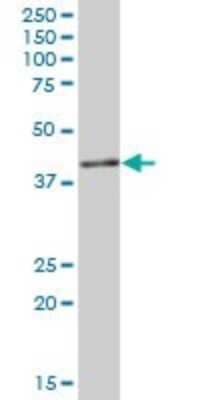 Western Blot: IGBP1 Antibody [H00003476-B01P] - Analysis of IGBP1 expression in human pancreas.