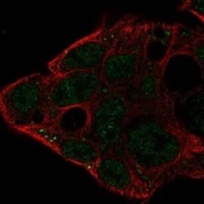 Immunocytochemistry/Immunofluorescence: IGDCC3 Antibody [NBP3-17384] - Staining of human cell line Hep G2 shows localization to nucleoplasm & vesicles.