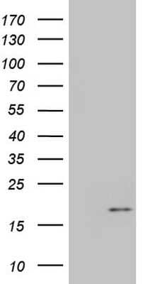 Western Blot: IGF-I Antibody (4B12) [NBP2-46037] - Analysis of HEK293T cells were transfected with the pCMV6-ENTRY control (Left lane) or pCMV6-ENTRY IGF-1.