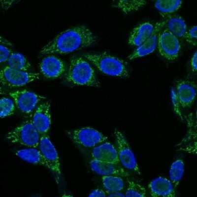 Immunocytochemistry/Immunofluorescence: IGF-I/IGF-1 Antibody (IGF1/1020) [NBP2-44968] - Immunofluorescence Analysis of HeLa cells labeling IGF-1 with IGF-I/IGF-1 Antibody (IGF1/1020) labeled with CF647R (Green). Nuclei are counter stained with DAPI (Blue).