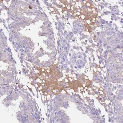 Immunohistochemistry-Paraffin: IGF-I/IGF-1 Antibody [NBP2-48922] - Staining of human endometrium shows moderate in plasma.