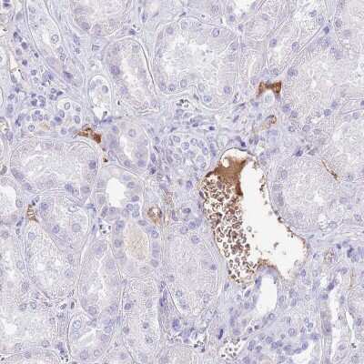 Immunohistochemistry-Paraffin: IGF-I/IGF-1 Antibody [NBP2-48922] - Staining of human kidney shows moderate positivity in plasma.