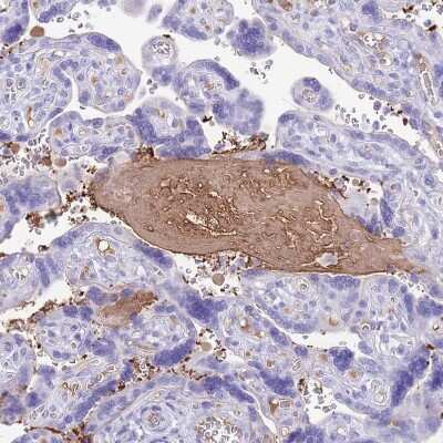 Immunohistochemistry-Paraffin: IGF-I/IGF-1 Antibody [NBP2-48922] - Staining of human placenta shows moderate positivity in plasma.