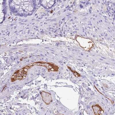 Immunohistochemistry-Paraffin: IGF-I/IGF-1 Antibody [NBP2-48922] - Staining of human rectum shows moderate positivity in plasma.