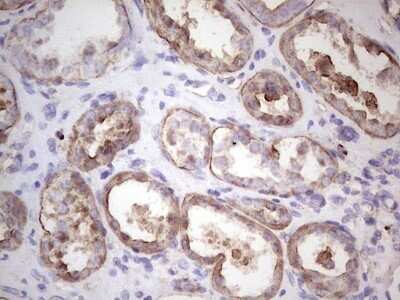 Immunohistochemistry: IGF-I/IGF-1 Antibody (OTI4B12) - Azide and BSA Free [NBP2-71010] - Analysis of Human Kidney tissue. (Heat-induced epitope retrieval by 1 mM EDTA in 10mM Tris, pH8.5, 120C for 3min)