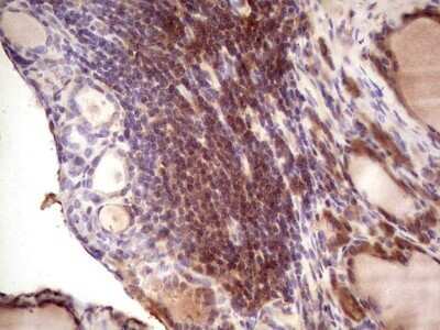 Immunohistochemistry: IGF-I/IGF-1 Antibody (OTI4B12) - Azide and BSA Free [NBP2-71010] - Analysis of Human thyroid tissue. (Heat-induced epitope retrieval by 1 mM EDTA in 10mM Tris, pH8.5, 120C for 3min)