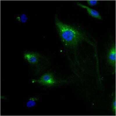 Immunocytochemistry/Immunofluorescence: IGF-II R/IGF2R Antibody (2G11) - Azide and BSA Free [NBP2-80785] - HMVEC Cells Image from the standard format of this antibody.