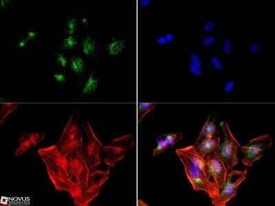 Immunocytochemistry/Immunofluorescence: IGF-II R/IGF2R Antibody (2G11) - Azide and BSA Free [NBP2-80785] - Mannose 6 Phosphate Receptor (Cation independent) antibody (2G11) was tested at (1:250) in HeLa cells with Dylight 488 (green). Nuclei and alpha-tubulin were counterstained with DAPI (blue) and DyLight-550 (red). Image from the standard format of this antibody.