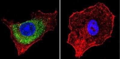 Immunocytochemistry/Immunofluorescence: IGF-II R/IGF2R Antibody (2G11) - Azide and BSA Free [NBP2-80785] - Mannose 6-Phosphate Receptor staining (green), F-Actin staining with Phalloidin (red) and nuclei with DAPI (blue) is shown. Cells were grown on chamber slides and fixed with formaldehyde prior to staining. Cells were probed without (control) or with or an antibody recognizing Mannose 6-Phosphate Receptor at a dilution of 1:20 over night at 4C, washed with PBS and incubated with a DyLight-488 conjugated. Image from the standard format of this antibody.