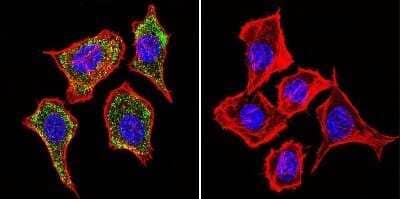 Immunocytochemistry/Immunofluorescence: IGF-II R/IGF2R Antibody (2G11) - Azide and BSA Free [NBP2-80785] - Staining in Hela Cells. Mannose 6-Phosphate Receptor staining (green), F-Actin staining with Phalloidin (red) and nuclei with DAPI (blue) is shown. Cells were grown on chamber slides and fixed with formaldehyde prior to staining. Cells were probed without (control) or with an antibody recognizing Mannose 6-Phosphate Receptor at a dilution of 1:20 over night at 4 C, washed with PBS and incubated with a DyLight-488 conjugated secondary antibody. Image from the standard format of this antibody.