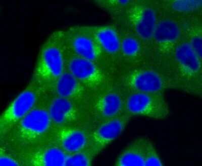 Immunocytochemistry/Immunofluorescence: IGF-II R/IGF2R Antibody (SR45-09) [NBP2-67347] - Staining M6PR in Hela cells (green). The nuclear counter stain is DAPI (blue). Cells were fixed in paraformaldehyde, permeabilised with 0.25% Triton X100/PBS.