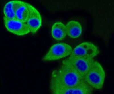 Immunocytochemistry/Immunofluorescence: IGF-II R/IGF2R Antibody (SR45-09) [NBP2-67347] - Staining M6PR in MCF-7 cells (green). The nuclear counter stain is DAPI (blue). Cells were fixed in paraformaldehyde, permeabilised with 0.25% Triton X100/PBS.