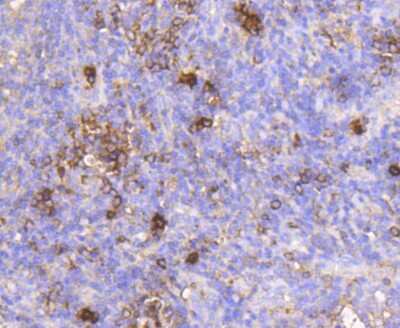 Immunohistochemistry-Paraffin: IGF-II R/IGF2R Antibody (SR45-09) [NBP2-67347] - Analysis of paraffin-embedded human tonsil tissue using anti-M6PR antibody. Counter stained with hematoxylin.