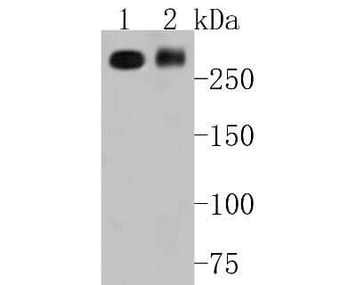 Western Blot: IGF-II R/IGF2R Antibody (SR45-09) [NBP2-67347] - Western blot analysis of IGF-II R/IGF2R on different lysates. Proteins were transferred to a PVDF membrane and blocked with 5% BSA in PBS for 1 hour at room temperature. The primary antibody (1/500) was used in 5% BSA at room temperature for 2 hours. Goat