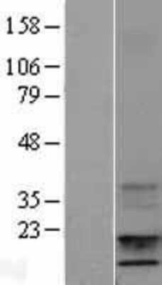 Western Blot: IGF1 Overexpression Lysate (Adult Normal) [NBL1-11866] Left-Empty vector transfected control cell lysate (HEK293 cell lysate); Right -Over-expression Lysate for IGF1.