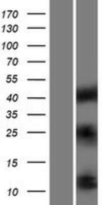 Western Blot: IGF1 Overexpression Lysate (Adult Normal) [NBP2-09381] Left-Empty vector transfected control cell lysate (HEK293 cell lysate); Right -Over-expression Lysate for IGF1.