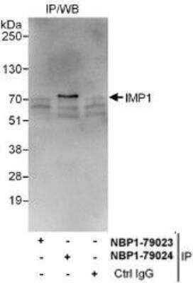 Immunoprecipitation: IGF2BP1 Antibody [NBP1-79024] - Whole cell lysate (1 mg for IP, 20% of IP loaded) from HeLa cells.  Antibodies: Affinity purified rabbit anti-IMP1 antibody  used for IP at 6 mcg/mg lysate.  IMP1 was not successfully immunoprecipitated by rabbit anti-IMP1 antibody NBP1-79023, which recognizes an upstream epitope.