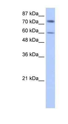 Western Blot: IGF2BP1 Antibody [NBP1-57495] - HepG2 cell lysate, concentration 0.2-1 ug/ml.