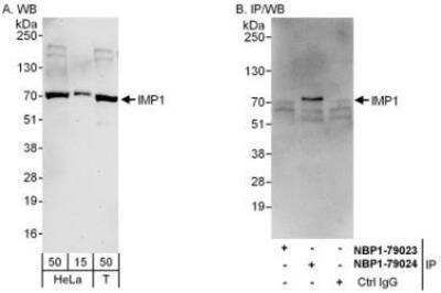 Western Blot: IGF2BP1 Antibody [NBP1-79023] - Whole cell lysate from HeLa (15 and 50 mcg for WB; 1 mg for IP, 20% of IP loaded) and 293T (T; 50 mcg) cells.  Antibodies: Affinity purified rabbit anti-IMP1 antibody used for WB at 0.1 mcg/ml (A) and 1 mcg/ml (B) and used for IP at 6 mcg/mg lysate.  IMP1 was successfully immunoprecipitated by rabbit anti-IMP1 antibody NBP1-79024  which recognizes a downstream epitope.