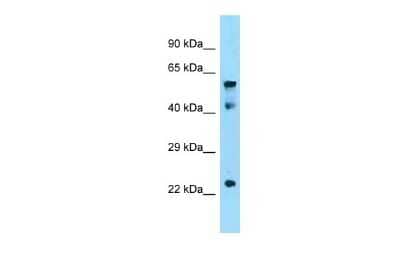 Western Blot: IGF2BP1 Antibody [NBP2-36473] - Titration: 1.0 ug/ml Positive Control: Mouse Thymus