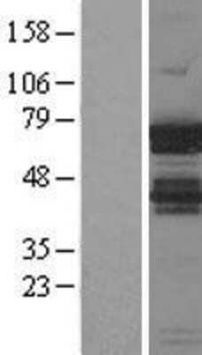 Western Blot: IGF2BP1 Overexpression Lysate (Adult Normal) [NBL1-11870] Left-Empty vector transfected control cell lysate (HEK293 cell lysate); Right -Over-expression Lysate for IGF2BP1.